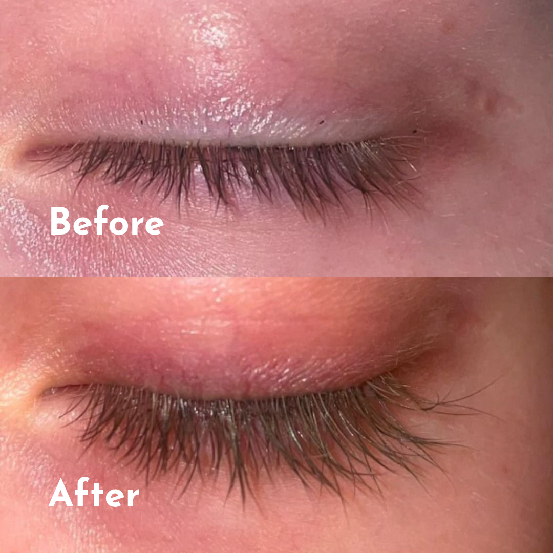 Eyelash Growth Serum